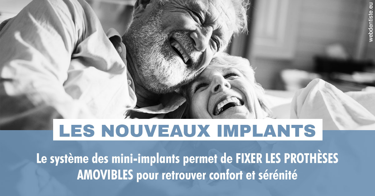 https://www.orthodontiste-st-etienne.fr/Les nouveaux implants 2
