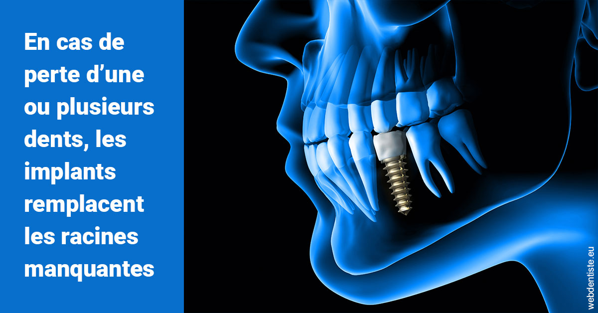 https://www.orthodontiste-st-etienne.fr/Les implants 1