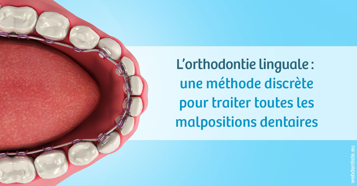 https://www.orthodontiste-st-etienne.fr/L'orthodontie linguale 1