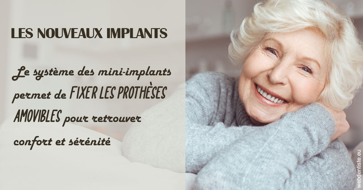 https://www.orthodontiste-st-etienne.fr/Les nouveaux implants 1