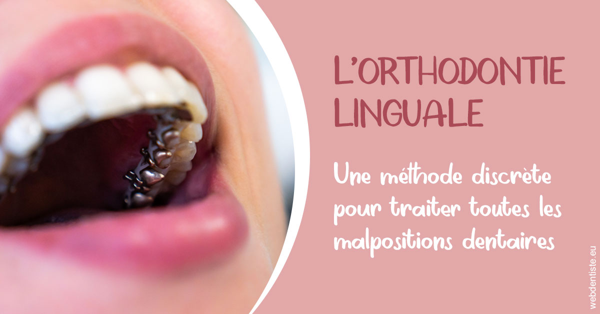 https://www.orthodontiste-st-etienne.fr/L'orthodontie linguale 2
