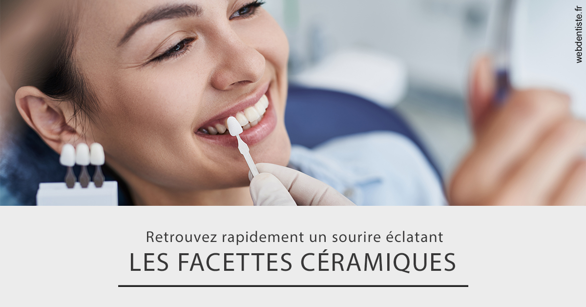 https://www.orthodontiste-st-etienne.fr/Les facettes céramiques 2