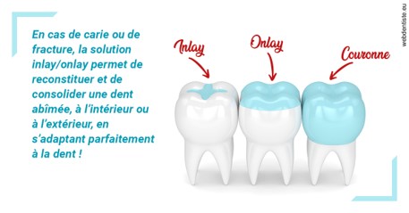 https://www.orthodontiste-st-etienne.fr/L'INLAY ou l'ONLAY