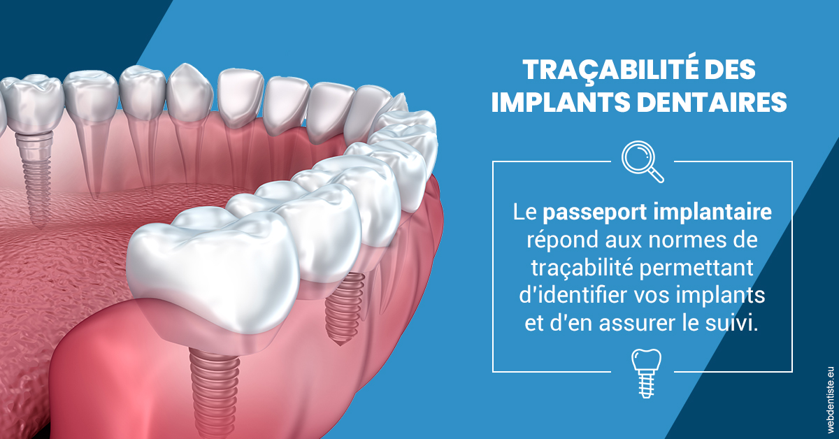 https://www.orthodontiste-st-etienne.fr/T2 2023 - Traçabilité des implants 1