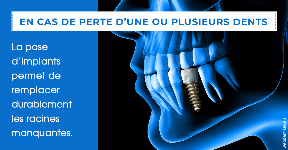 https://www.orthodontiste-st-etienne.fr/2024 T1 - Implants 01