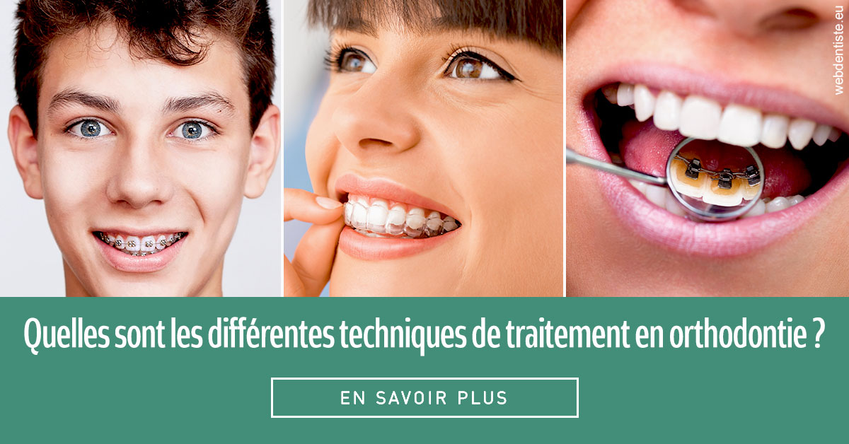 https://www.orthodontiste-st-etienne.fr/Les différentes techniques de traitement 2