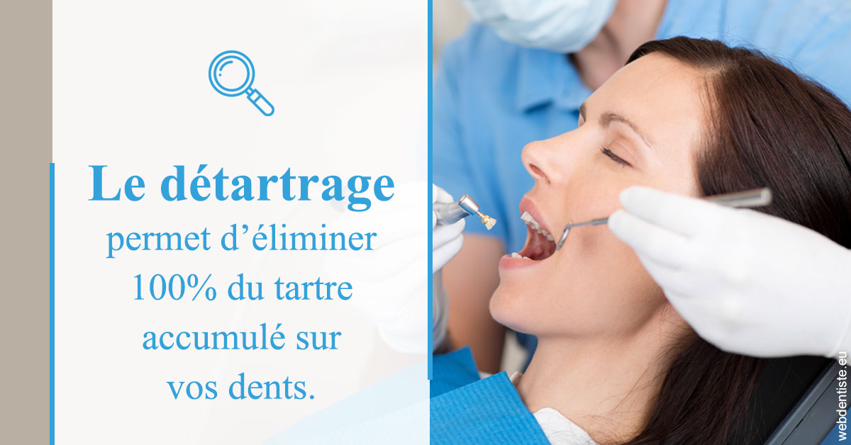 https://www.orthodontiste-st-etienne.fr/En quoi consiste le détartrage