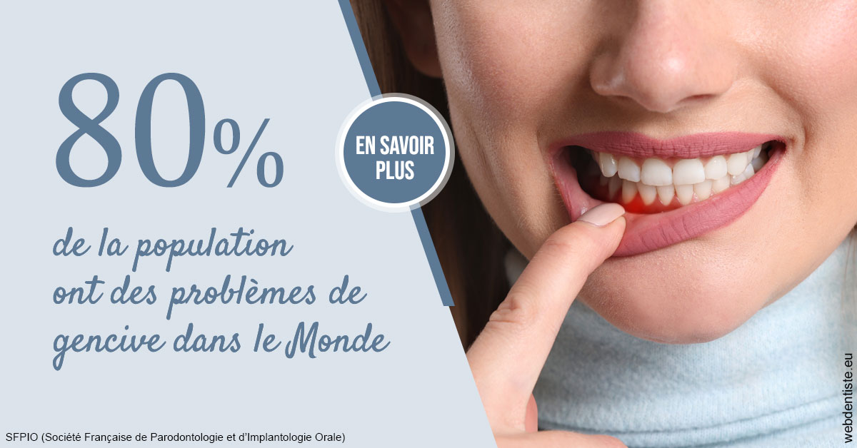https://www.orthodontiste-st-etienne.fr/Problèmes de gencive 2