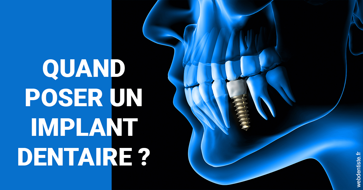 https://www.orthodontiste-st-etienne.fr/Les implants 1