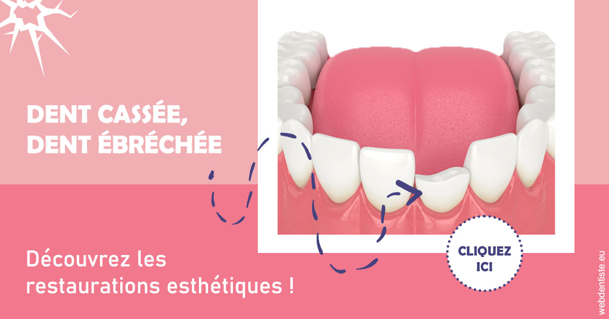 https://www.orthodontiste-st-etienne.fr/Dent cassée ébréchée 1