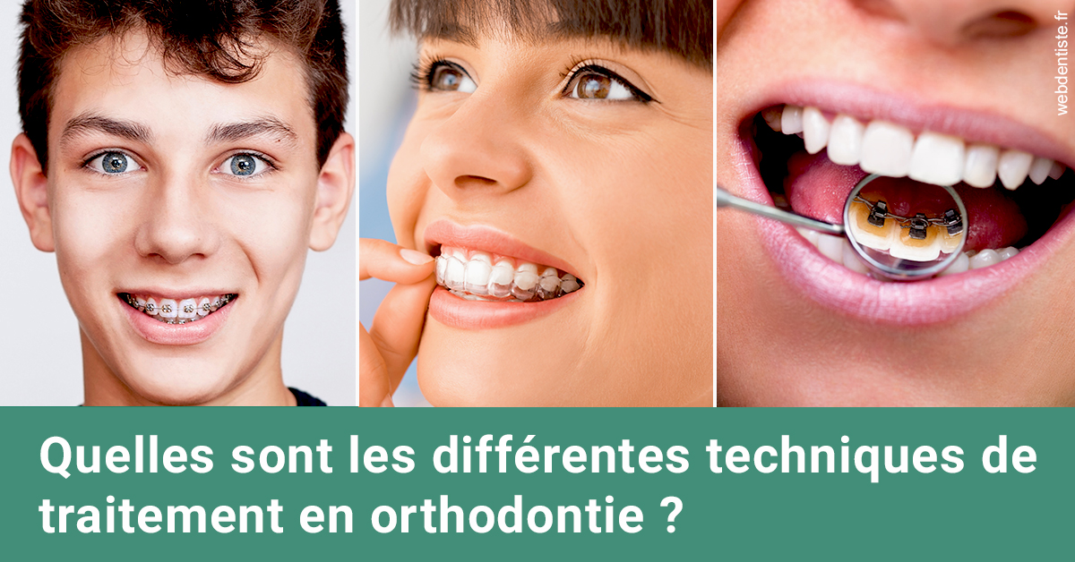 https://www.orthodontiste-st-etienne.fr/Les différentes techniques de traitement 2