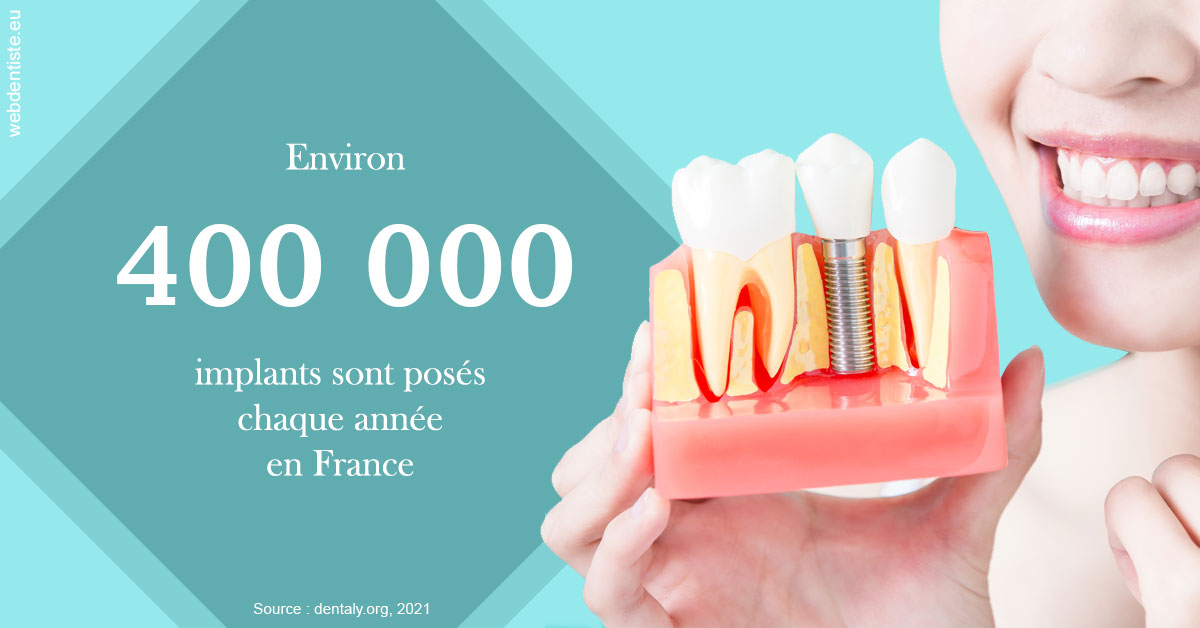 https://www.orthodontiste-st-etienne.fr/Pose d'implants en France 2