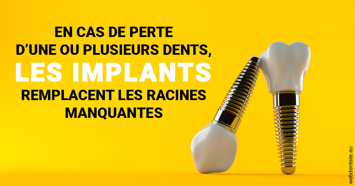 https://www.orthodontiste-st-etienne.fr/Les implants 2
