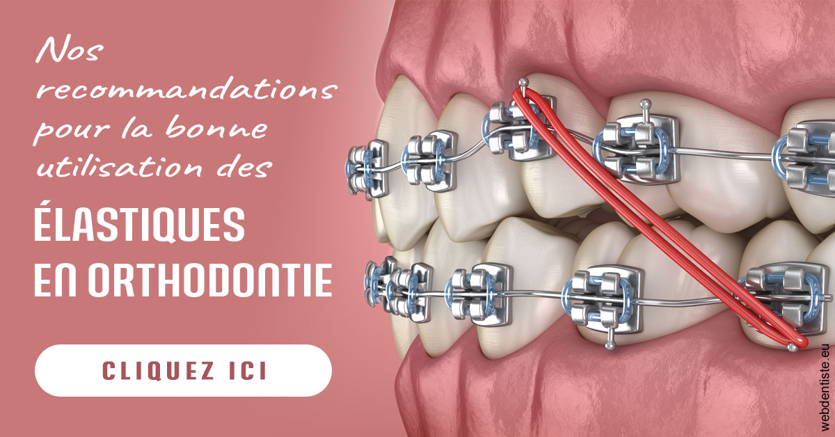 https://www.orthodontiste-st-etienne.fr/Elastiques orthodontie 2