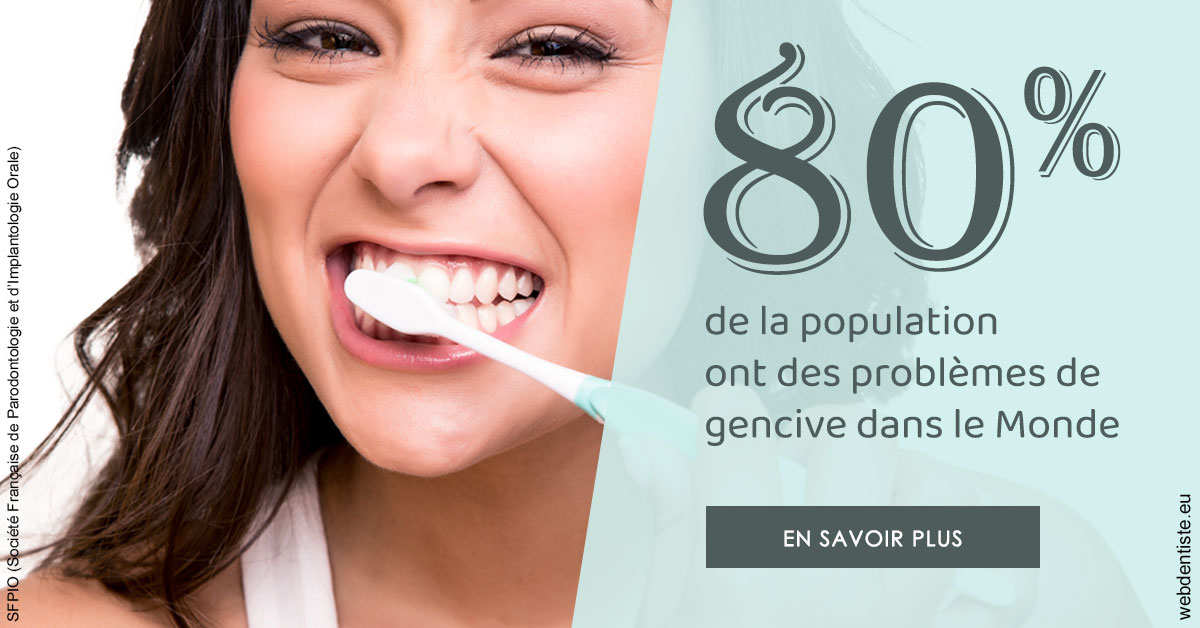 https://www.orthodontiste-st-etienne.fr/Problèmes de gencive 1