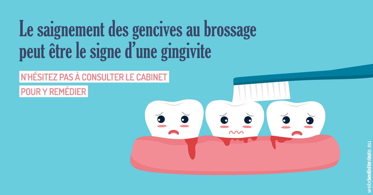 https://www.orthodontiste-st-etienne.fr/2023 T4 - Saignement des gencives 02